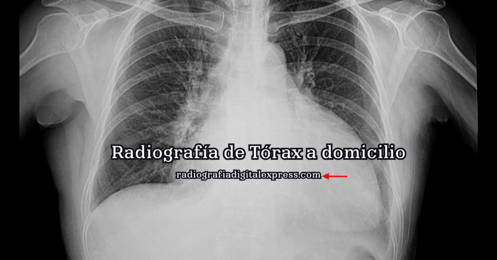 radiografía de torax a domicilio en guadalajara
